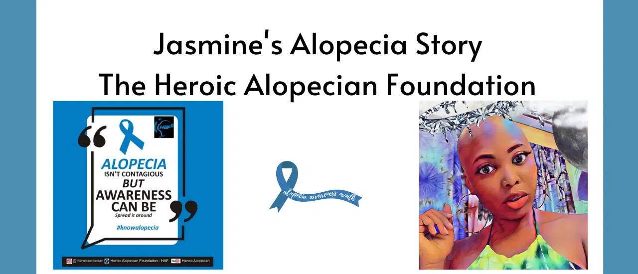 Jasmine's Alopecia Story and The Heroic Alopecian Foundation | Blog