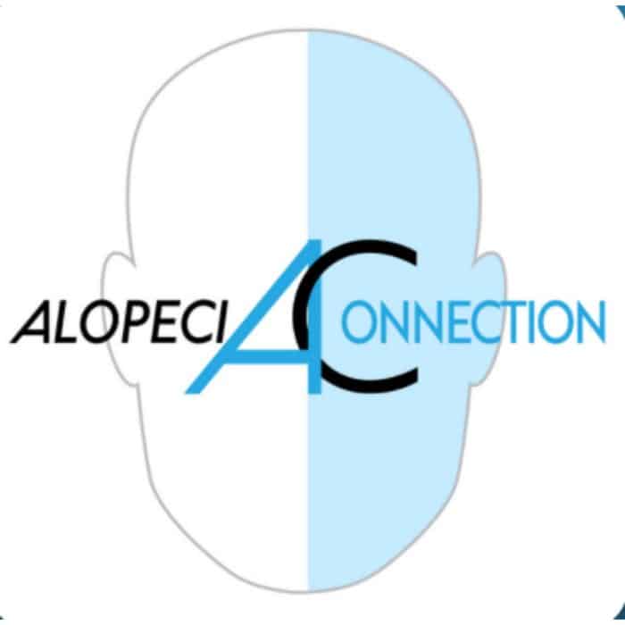 Alopecia Connection Podcast | Blog Post | Alopecia Resources